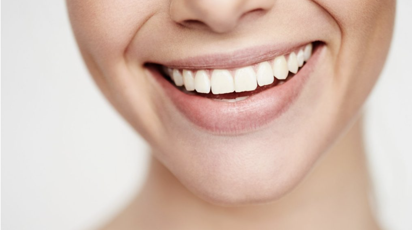 A Dazzling Smile: How Important Is This and How to Get Yours Today